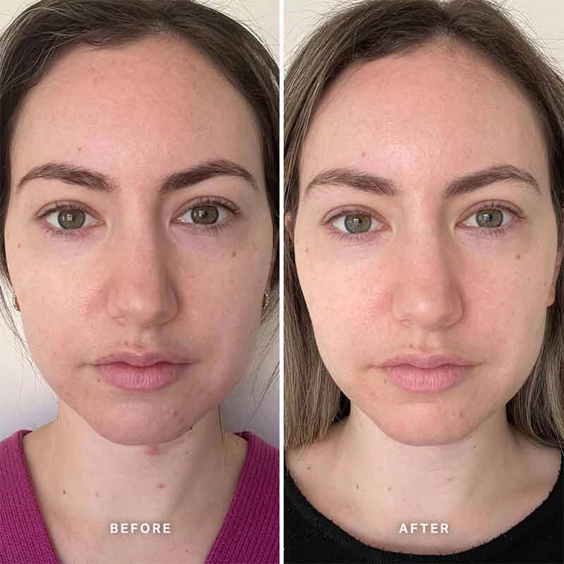 Alpha-H Vitamin B Serum with 5% Niacinamide