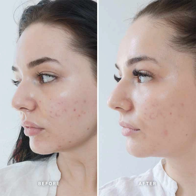 Alpha-H Vitamin B Serum with 5% Niacinamide