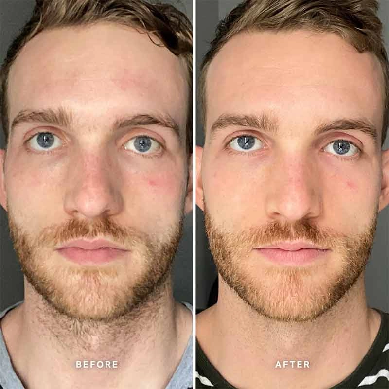 Alpha-H Vitamin B Serum with 5% Niacinamide