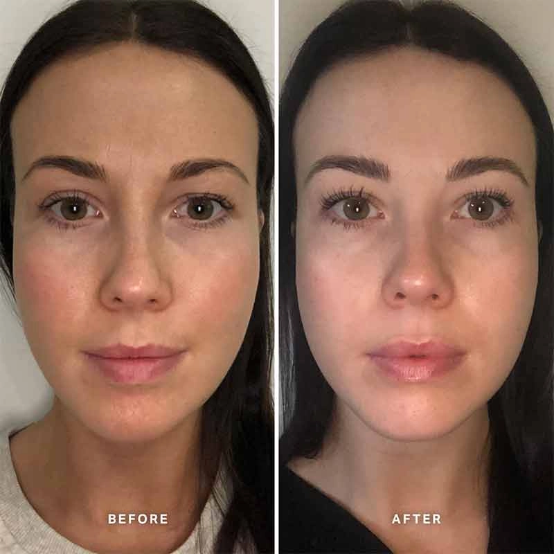 Alpha-H Vitamin B Serum with 5% Niacinamide